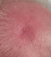 Final Picture - Week 18