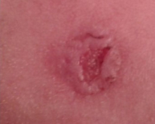 Six Weeks After Using Perrin's Blend