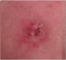 Nine Weeks After Using Perrin's Blend