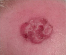 Before Using Perrin's Blend