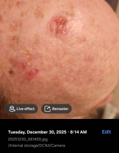 Dr. Patrick Before