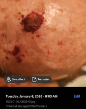 Dr. Patrick During Perrin's Blend photo 2