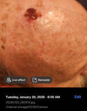 Dr. Patrick During Perrin's Blend photo 4