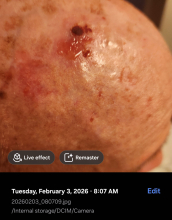 Dr. Patrick During Perrin's Blend photo 6