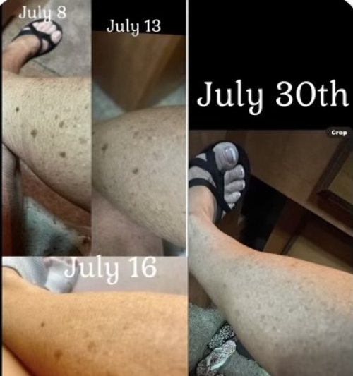 Before, During, and After Using Creme Complete